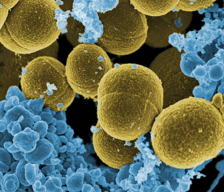 Apariţia rezistenţei la meticilină a Staphylococcus aureus precede utilizarea clinică a antibioticelor